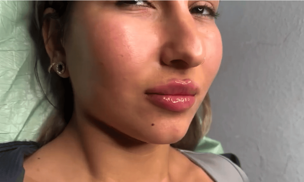 Ästhetische Behandlung 12
