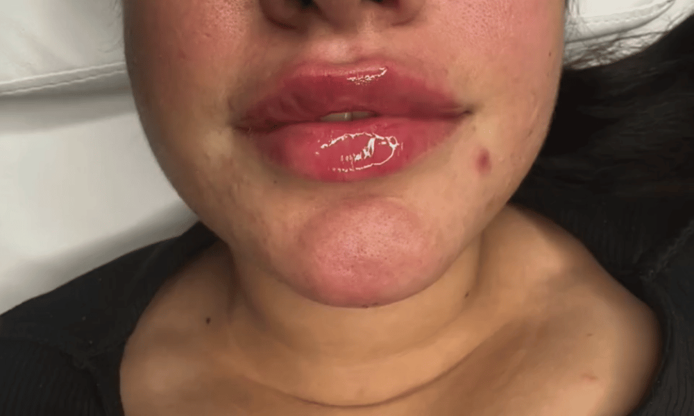 Ästhetische Behandlung 16
